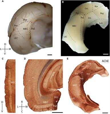 Complementary Modular Microcircuits of the Rat Medial Entorhinal Cortex